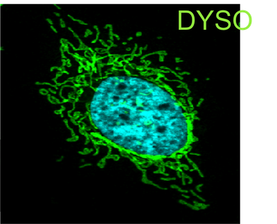 Logo DYSO